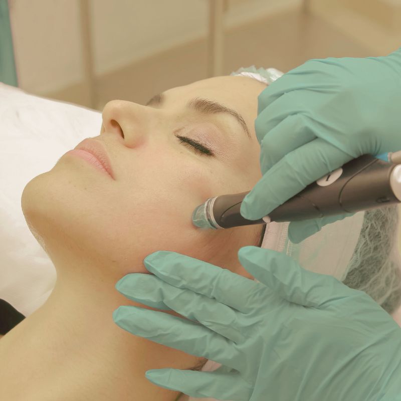 Acne Treatment image