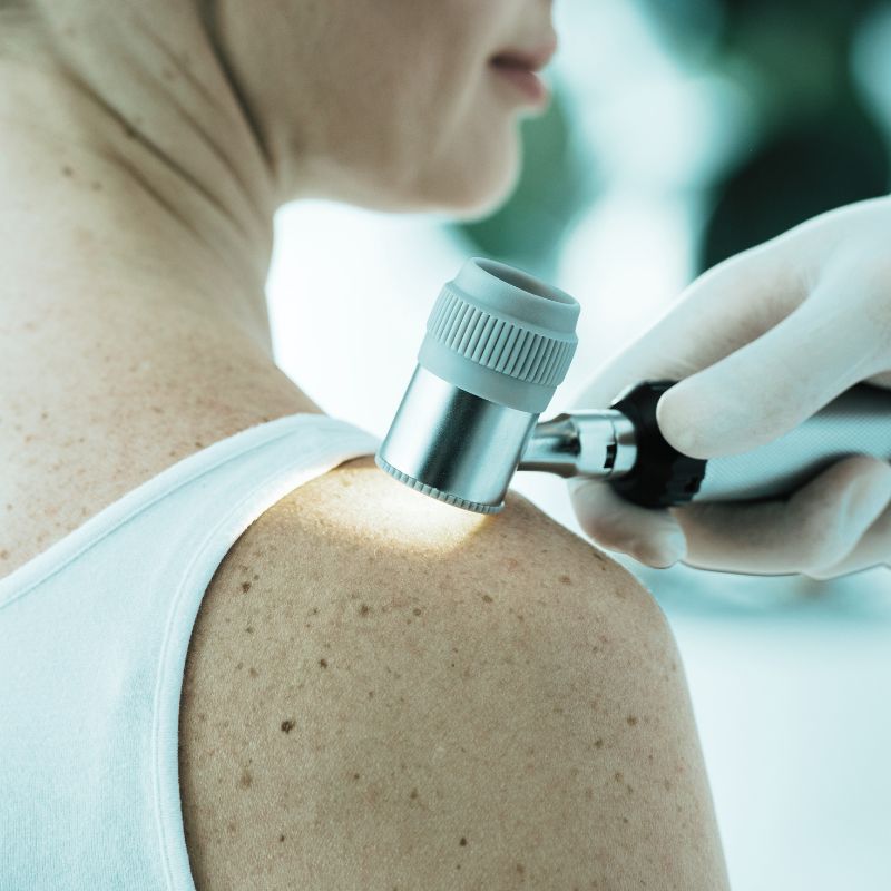 Dermatology care