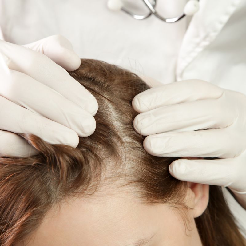 Hair Loss Doctor in Tenerife img