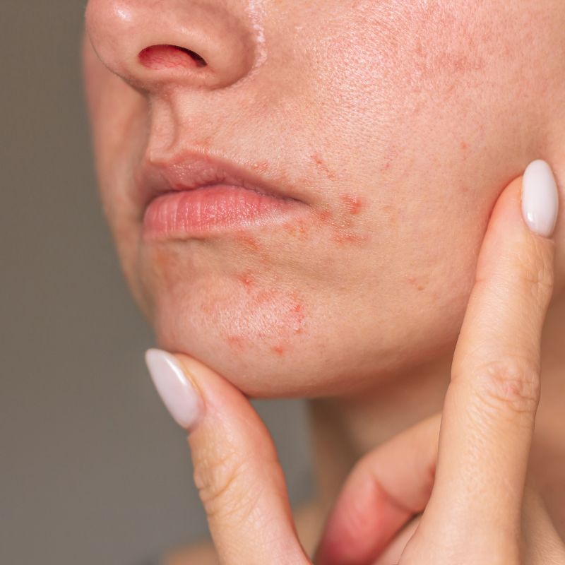 Not Sure What Skin Condition You Have? Not Sure What Skin Condition You Have?