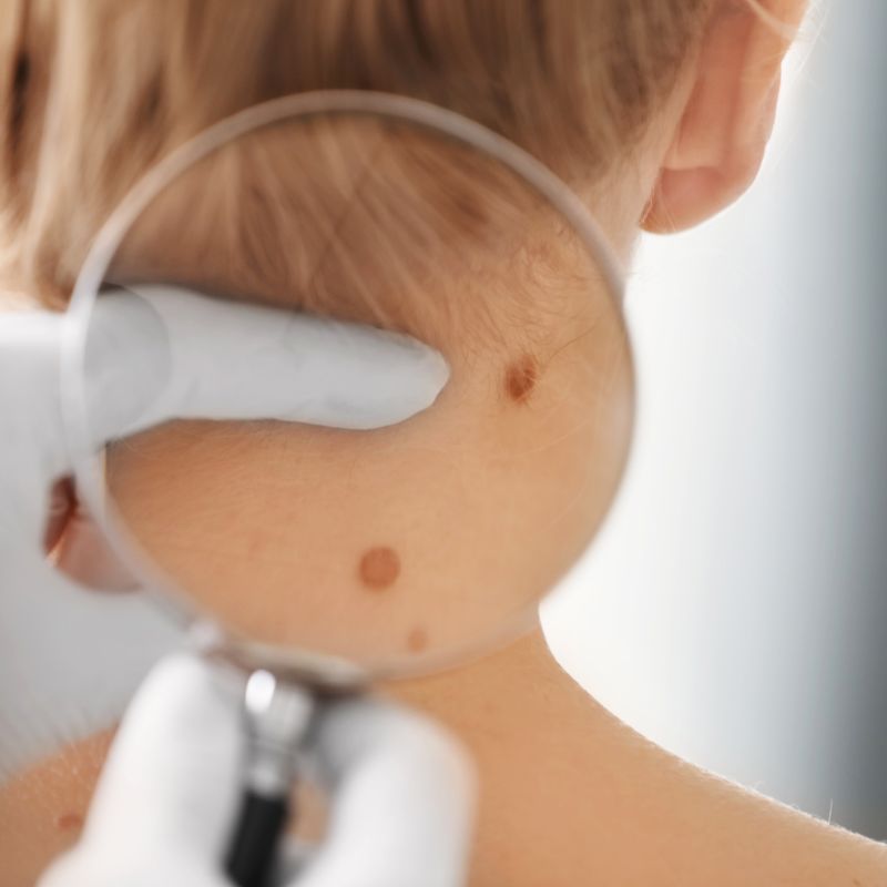 dermatologist consultation patient