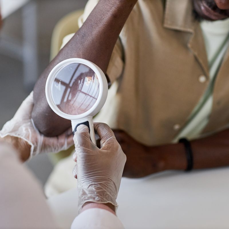 dermatologist examining patient arm